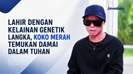 Dibully Karena Kulit Merah Sejak Lahir, Koko Merah Temukan Damai dalam Tuhan