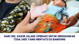 Hari Ini, Sagir Jalani Operasi untuk Memisahkan Tiga Jari yang Menyatu di Bandung