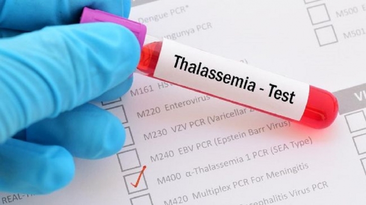 Batal Nikah Karena Idap Penyakit Thalassemia? Kenali Bahaya dan Gejalanya