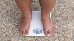 Anak Mengalami Obesitas? Berikut Hal Yang Perlu Diperhatikan