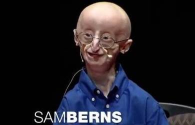 Sam Berns, Penderita Progeria Yang Inspiratif Tutup Usia