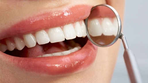 Nggak Perlu Ke Dokter, Putihkan Gigi Dengan 5 Cara Rumahan Super Murah Ini Aja