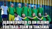 Laga El Clasico Dukung Para Albino di Tanzania