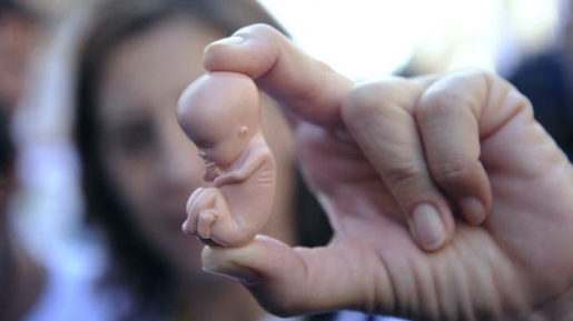 RUU Baru Melarang Aborsi, Kelompok Kristen Sambut dengan Sukacita