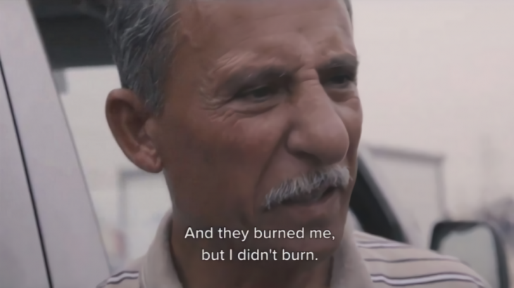 Tiga Kali Dibakar Hidup-hidup Oleh ISIS, Pria Ini Mengaku Selamat Karena Yesus