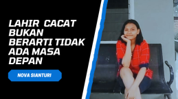 Lahir Cacat dan Cobaan Bertubi-tubi Bikin Nova Mau Menghilang