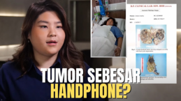 Kisah Nyata Seorang Wanita 20 Tahun Idap Tumor Sebesar Handphone, Berikut Cerita Jesslyn A