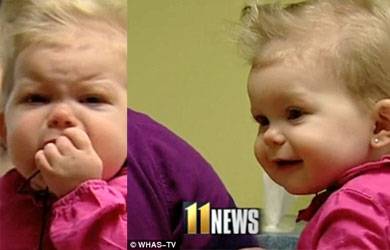 Reaksi Bayi Tuli Setelah Bisa Dengar 