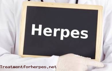 Gejala Herpes Hingga Metode Penyembuhan