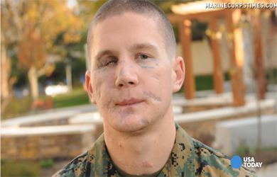 Berkorban Demi Rekan, Tubuh Kyle Carpenter Rela Hancur