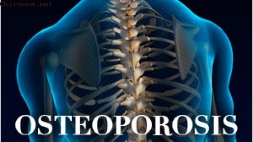 Say No to Osteoporosis! Jauhi Kebiasaan ini