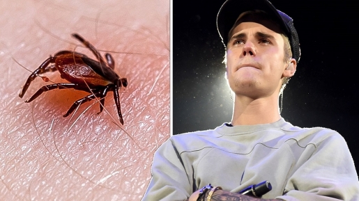 Mengenal Penyakit Lyme yang Didiagnosa Justin Bieber,Ternyata Ini Sebabnya