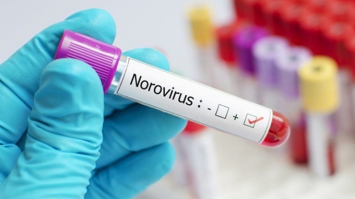 Bukan Virus Baru, Begini Sejarah Munculnya Norovirus dan Cara Pencegahannya…