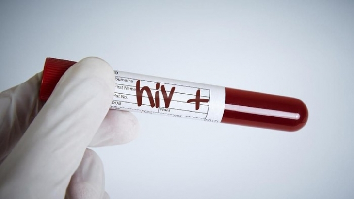 16 Tanda Penderita Positif HIV