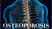 Say No to Osteoporosis! Jauhi Kebiasaan ini