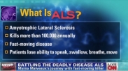 Mengenal Penyakit ALS Stephen Hawking