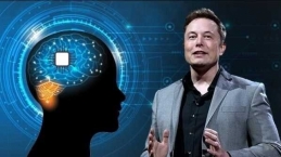 Implan Chip Otak Elon Musk yang Rencananya Akan Diuji Coba ke Manusia Tuai Pro dan Kontra