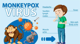 Monkeypox di Indonesia Terus Meningkat! Yuk Kenali Gejala, Pencegahan dan Pengobatannya