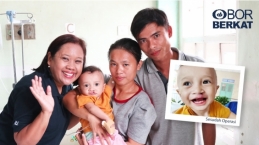 Hidup 10 Anak Ini Berubah Selamanya Berkat Operasi Bibir Sumbing OBI
