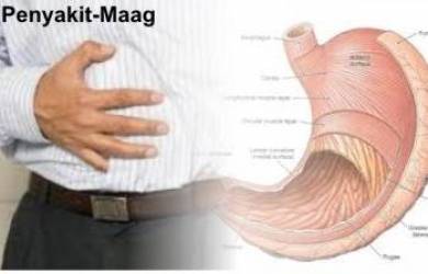 Ini Gejala Psikis Penyebab Masalah Lambung