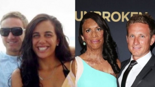 Turia Pitt dan Michael Hoskin’s, Cinta yang Teruji