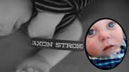 Jaxon Strong, Bayi yang Bertahan dengan Separuh Tengkorak