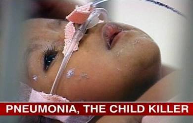 Satu dari 5 Kematian Anak Disebabkan oleh Pneumonia